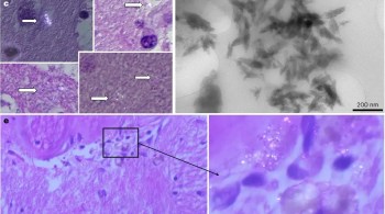 Amostras analisadas por pesquisadores da Universidade do Novo México continham até uma colher de fragmentos de plástico