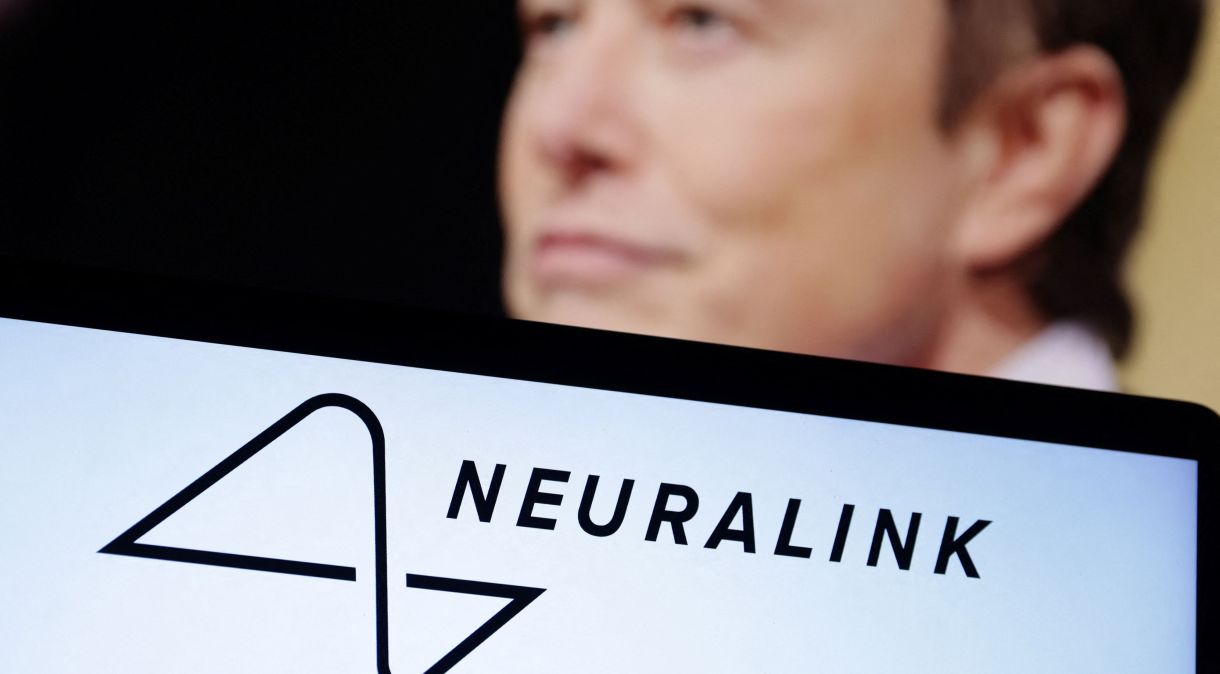Primeiro chip cerebral humano da Neuralink apresenta falha --mas tem solução