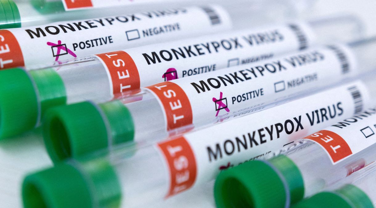 Tubos de ensaio com rótulos sobre varíola dos macacos